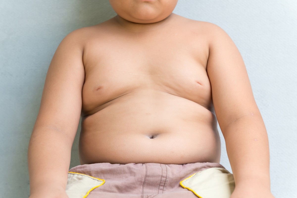 Obesity Day: quasi un italiano su due è sovrappeso