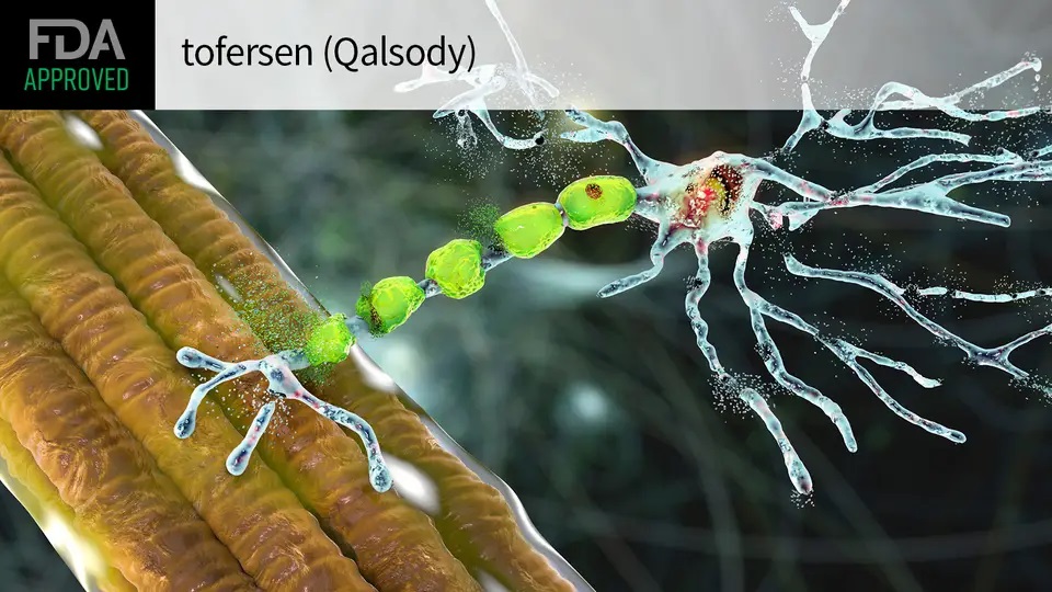 Il Qalsody (tofersen) approvato da FDA