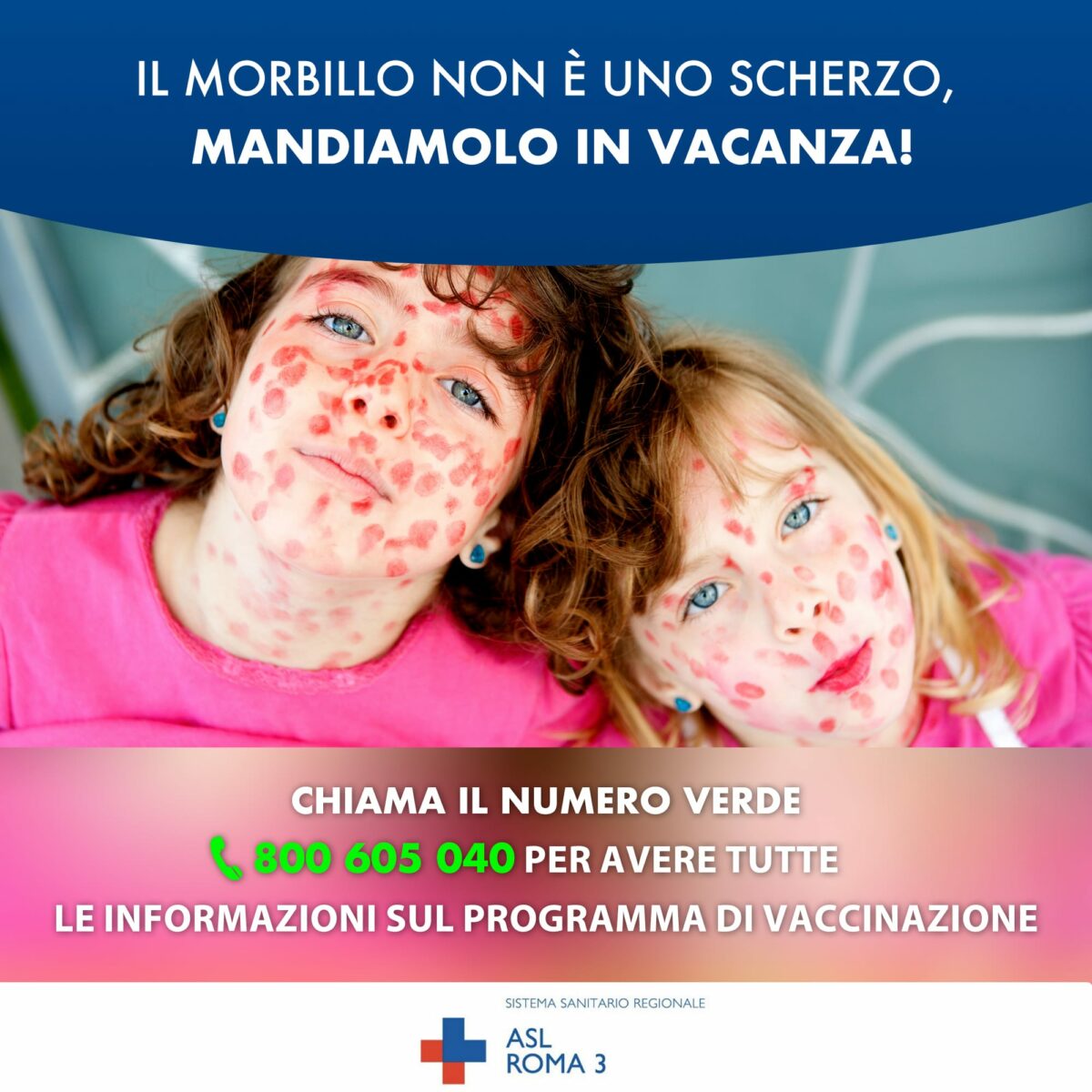 Casi di morbillo in crescita sul territorio della ASL Roma 3