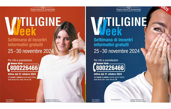 'Vitiligine Week' dal 25 al 30 novembre