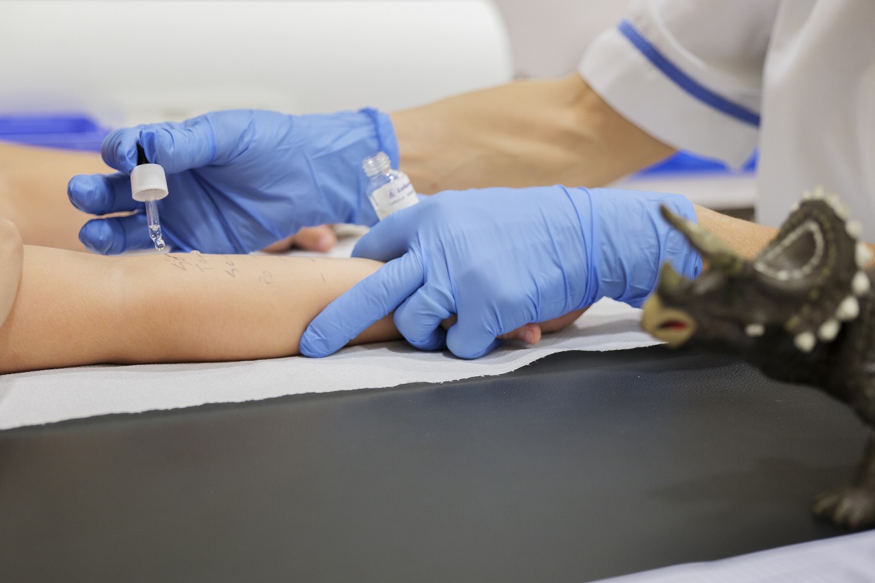 Un nuovo test sul sangue dei bambini allergici al Bambino Gesù