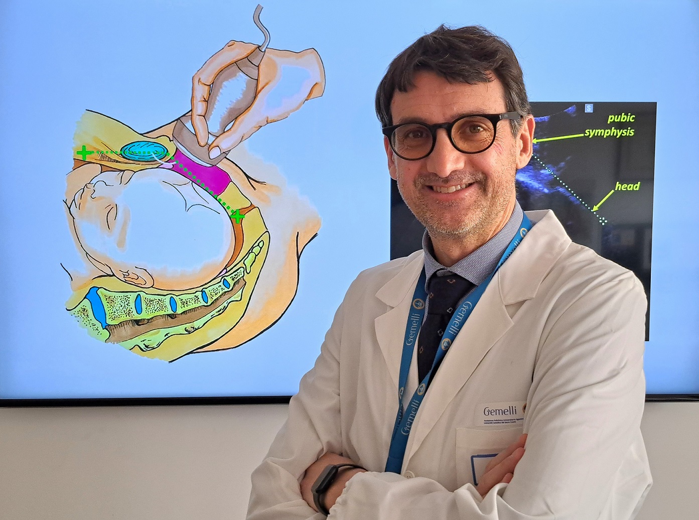 Speciale ecografia al Gemelli per le nascite difficili
