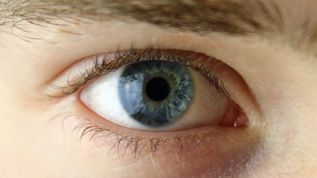 Glaucoma con IAPB Italia ETS in prima linea