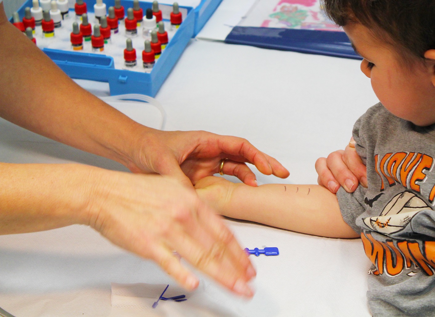 Aumentano i casi di allergie dei bambini con l'arrivo della primavera